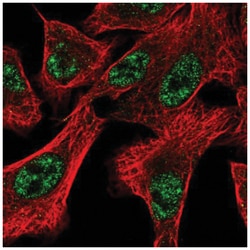 DOCK1 Antibody, Novus Biologicals 25 &mu;L, Unlabeled:Antibodies, Polyclonal