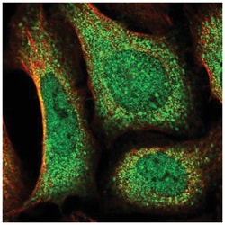 DOCK10 Antibody, Novus Biologicals 100&mu;L; Unlabeled:Antibodies, Polyclonal