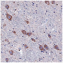 Human Dopamine D2 R/DRD2 Antibody, R D Systems 100&mu;g; Unlabeled:Antibodies,
