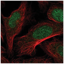 DOT1L Antibody, Novus Biologicals 100&mu;L; Unlabeled:Antibodies, Polyclonal