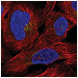 DPPII/QPP/DPP7 Antibody, Novus Biologicals 100&mu;L; Unlabeled:Antibodies,