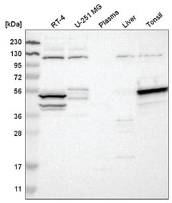 DRAK1 Antibody, Novus Biologicals 100&mu;L; Unlabeled:Antibodies, Polyclonal