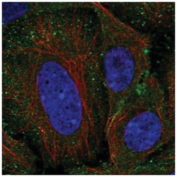 DSS1 Antibody, Novus Biologicals 100&mu;L; Unlabeled:Antibodies, Polyclonal