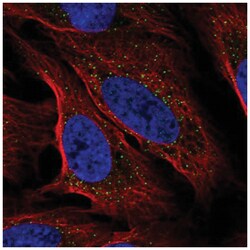 DSU Antibody, Novus Biologicals 100&mu;L; Unlabeled:Antibodies, Polyclonal
