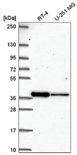 DTW Domain Containing 2 Antibody, Novus Biologicals 100&mu;L; Unlabeled:Antibodies,