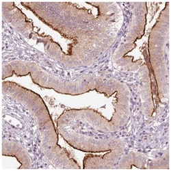 DUOXA2 Antibody, Novus Biologicals 25 &mu;L, Unlabeled:Antibodies, Polyclonal