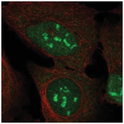 DUX4 Antibody, Novus Biologicals:Antibodies:Primary Antibodies