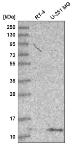 DYNLT1 Antibody, Novus Biologicals 100&mu;L; Unlabeled:Antibodies, Polyclonal