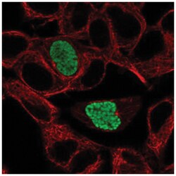 Dyrk1B Antibody, Novus Biologicals 100&mu;L; Unlabeled:Antibodies, Polyclonal