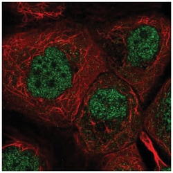 DYRK2 Antibody, Novus Biologicals:Antibodies:Primary Antibodies