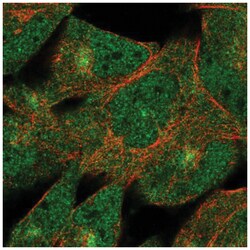 DZIP1 Antibody, Novus Biologicals 25 &mu;L:Antibodies, Polyclonal
