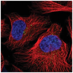 DZIP3 Antibody, Novus Biologicals 100 &mu;L | Buy Online | Novus Biologicals | Fisher Scientific