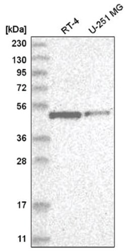 E2F-1 Antibody, Novus Biologicals:Antibodies:Primary Antibodies