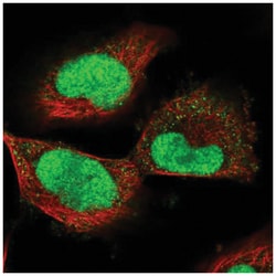 ECT2 Antibody, Novus Biologicals 100&mu;L; Unlabeled:Antibodies, Polyclonal