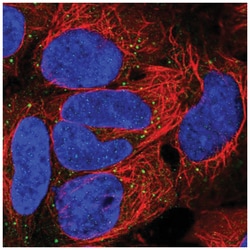 EDA/Ectodysplasin Antibody, Novus Biologicals 100&mu;L; Unlabeled:Antibodies,