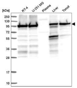 eEF-2 Antibody, Novus Biologicals 25 &mu;L, Unlabeled:Antibodies, Polyclonal