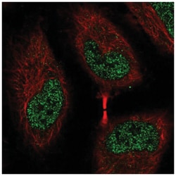 EEF2K Antibody, Novus Biologicals 25 &mu;L, Unlabeled:Antibodies, Polyclonal
