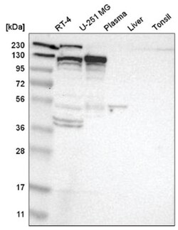 Eg5 Antibody, Novus Biologicals 100&mu;L; Unlabeled:Antibodies, Polyclonal