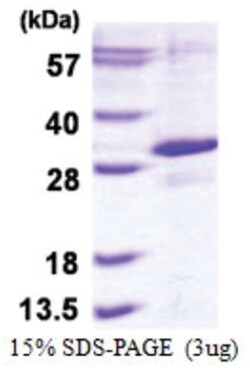 Novus Biologicals&trade;&nbsp;Recombinant Human EGLN3/PHD3 Protein
