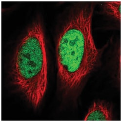 EGR1 Antibody, Novus Biologicals:Antibodies:Primary Antibodies