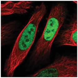 EGR1 Antibody, Novus Biologicals:Antibodies:Primary Antibodies