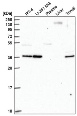 EHF Antibody, Novus Biologicals:Antibodies:Primary Antibodies