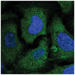 EIF2 beta Antibody, Novus Biologicals 25 &mu;L; Unlabeled:Antibodies, Polyclonal