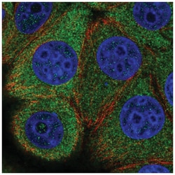 eIF2B epsilon Antibody, Novus Biologicals 100&mu;L; Unlabeled:Antibodies,