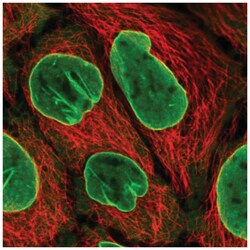 eIF2B4 Antibody, Novus Biologicals 25 &mu;L, Unlabeled:Antibodies, Polyclonal