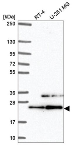 eIF3K Antibody, Novus Biologicals:Antibodies:Primary Antibodies