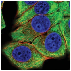 eIF4B Antibody, Novus Biologicals 25 &mu;L:Antibodies, Polyclonal