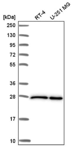 eIF4E Antibody, Novus Biologicals:Antibodies:Primary Antibodies