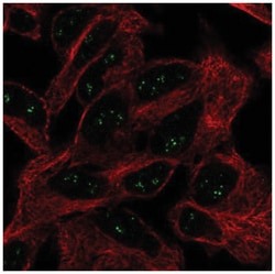 EIF4E3 Antibody, Novus Biologicals 25 &mu;L:Antibodies, Polyclonal