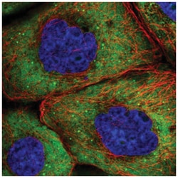 eIF4G1 Antibody, Novus Biologicals 25 &mu;L:Antibodies, Polyclonal