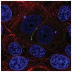 EIG121 Antibody, Novus Biologicals 100&mu;L; Unlabeled:Antibodies, Polyclonal