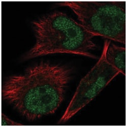 ELAC1 Antibody, Novus Biologicals 100&mu;L; Unlabeled:Antibodies, Polyclonal