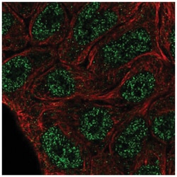 ELF5 Antibody, Novus Biologicals:Antibodies:Primary Antibodies