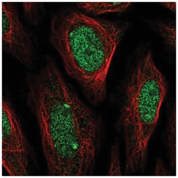 Elk-1 Antibody, Novus Biologicals 100&mu;L; Unlabeled:Antibodies, Polyclonal