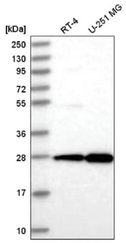 EMG1 Antibody, Novus Biologicals 100&mu;L; Unlabeled:Antibodies, Polyclonal