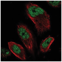 EMSY Antibody, Novus Biologicals 25 &mu;L | Buy Online | Novus Biologicals | Fisher Scientific