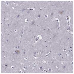 EN1/Engrailed 1 Antibody, Novus Biologicals 100&mu;L; Unlabeled:Antibodies,