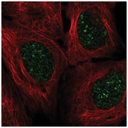 engrailed homeobox 2 Antibody, Novus Biologicals 100&mu;L; Unlabeled:Antibodies,