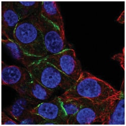 EPB41 Antibody, Novus Biologicals 25 &mu;L, Unlabeled:Antibodies, Polyclonal
