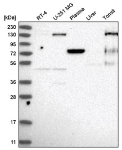 EPB41 Antibody, Novus Biologicals 100&mu;L; Unlabeled:Antibodies, Polyclonal