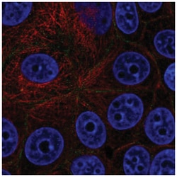 EpCAM/TROP1 Antibody, Novus Biologicals 100&mu;L; Unlabeled:Antibodies,