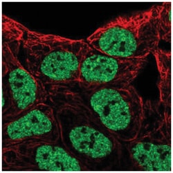 EphB6 Antibody, Novus Biologicals:Antibodies:Primary Antibodies