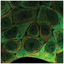 epithelial Sodium Channel gamma Antibody, Novus Biologicals 25 &mu;L, Unlabeled:Antibodies,