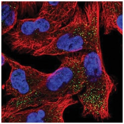 Epsin-2 Antibody, Novus Biologicals 25 &mu;L, Unlabeled:Antibodies, Polyclonal