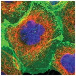 ErbB2/Her2 Antibody, Novus Biologicals 25 &mu;L:Antibodies, Polyclonal