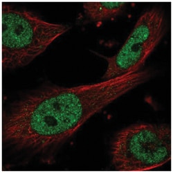 ERCC1 Antibody, Novus Biologicals 100&mu;L; Unlabeled:Antibodies, Polyclonal